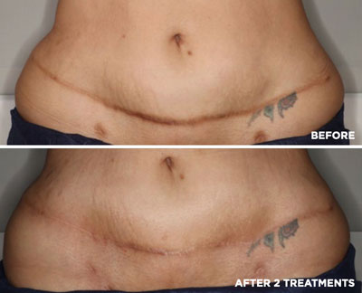 vipeel body soho nyc